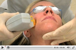 broad band light therapy-youtube